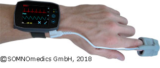 Langzeit-Blutdruckmessung per Fingerclip und Langzeit-EKG